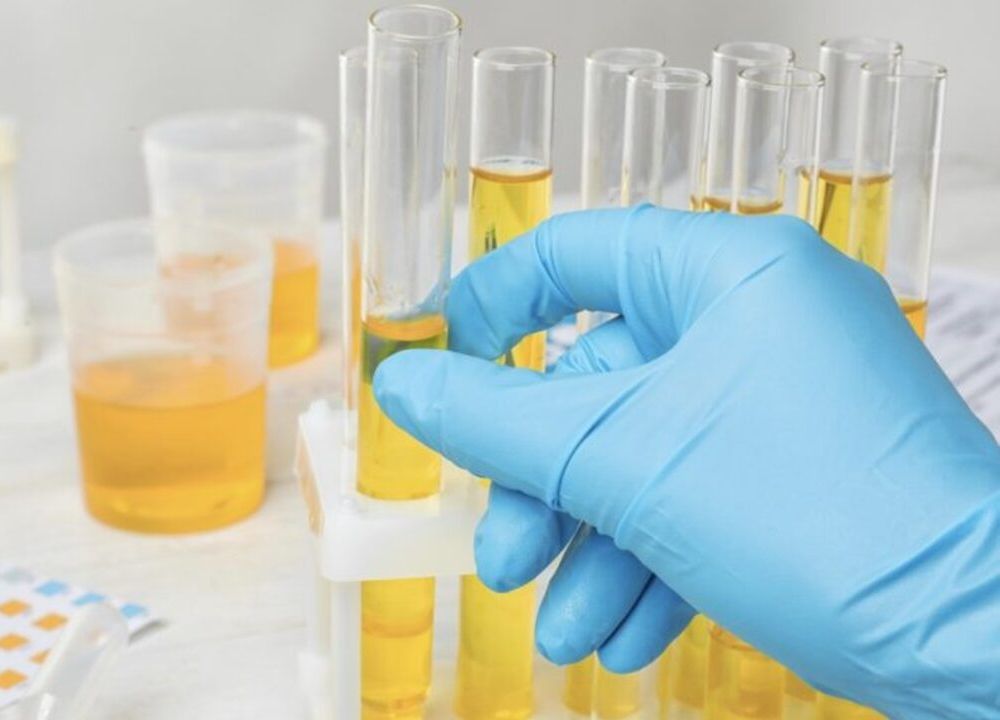 Urine